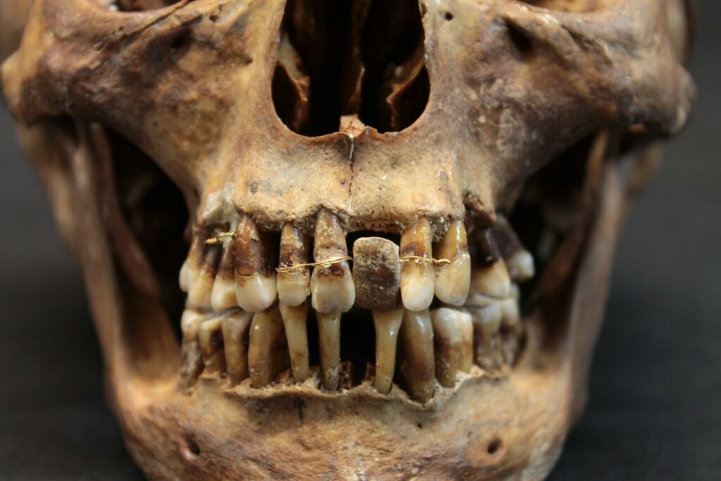 secreto dental Anne d'Alègre