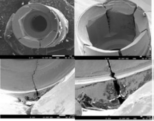 propagación de grietas por torque excesivo en conexiones internas hexagonales